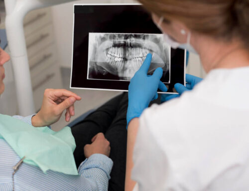 The Role of Dental X-Rays in Modern Dentistry: Insights from Eicon Dental