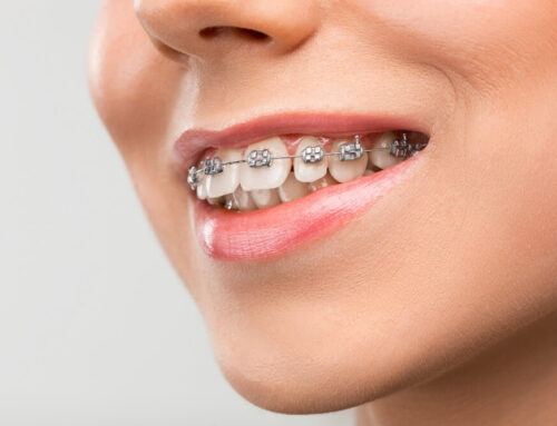 Orthodontics: Transform Your Smile with Braces or Invisalign at Eicon Dental