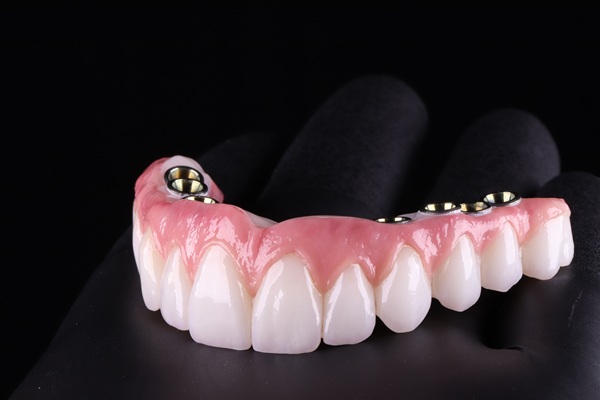 Dental prosthesis on black gloved hand.