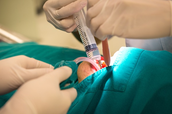 Medical procedure with syringe and surgical gloves.