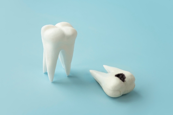 Prevent Tooth Decay With Regular Dental Cleanings